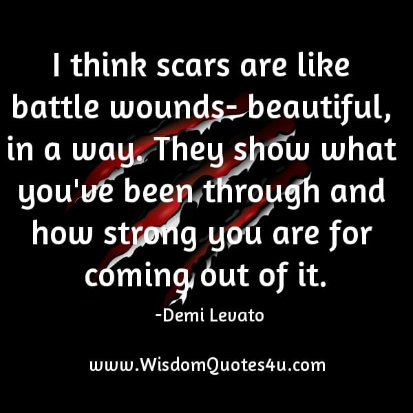 Scars are like battle wounds - Beautiful, in a way