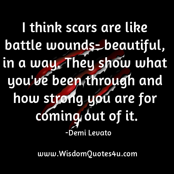 Scars are like battle wounds – Beautiful, in a way
